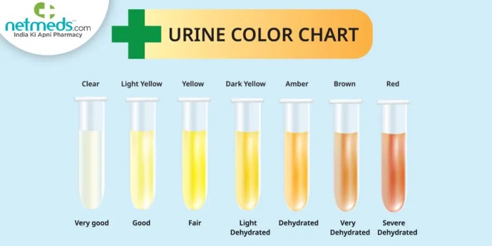 Can food coloring affect your urine