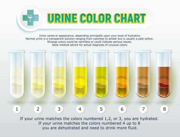 Can food coloring affect your urine